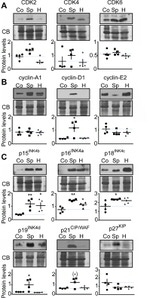 CDKN2C Antibody in Western Blot (WB)