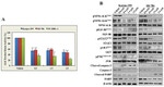 IGF1R beta Antibody in Western Blot (WB)