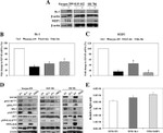 IGF1R beta Antibody in Western Blot (WB)