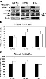 IGF1R beta Antibody in Western Blot (WB)