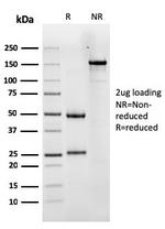 Luteinizing Hormone/Choriogonadotropin Receptor (LHCGR) Antibody in SDS-PAGE (SDS-PAGE)