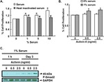 Phospho-SMAD2 (Ser465, Ser467) Antibody in Western Blot (WB)