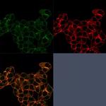 Lactotransferrin/Lactoferrin/LTF Antibody in Immunocytochemistry (ICC/IF)