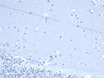 TACSTD2/TROP2 (Epithelial Marker) Antibody in Immunohistochemistry (Paraffin) (IHC (P))