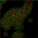 Ep-CAM/CD326 (Extracellular Domain) (Epithelial Marker) Antibody in Immunocytochemistry (ICC/IF)