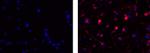 IgM Antibody in Immunocytochemistry (ICC/IF)