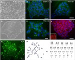 TRA-1-81 Antibody in Immunocytochemistry (ICC/IF)