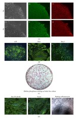 TRA-1-81 Antibody in Immunocytochemistry (ICC/IF)