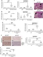 PAI1 Antibody in Immunohistochemistry (IHC)