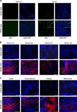 Dinitrophenyl-KLH Antibody in Immunohistochemistry (IHC)