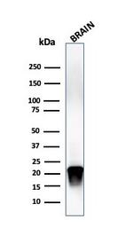 Phospho-Myelin Basic Protein (Marker of Oligodendrocytes and Myelin) (Thr98) Antibody in Western Blot (WB)