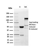 Myelin Basic Protein Antibody in SDS-PAGE (SDS-PAGE)