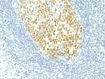 MCM7 (Proliferation Marker) Antibody in Immunohistochemistry (Paraffin) (IHC (P))