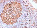MCM7 Antibody in Immunohistochemistry (Paraffin) (IHC (P))
