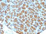 Milk Fat Globule (Breast Epithelial Marker) Antibody in Immunohistochemistry (Paraffin) (IHC (P))