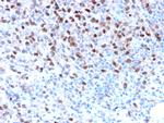 Microphthalmia Transcription Factor (MITF) Antibody in Immunohistochemistry (Paraffin) (IHC (P))