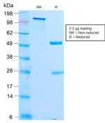 Microphthalmia Transcription Factor (MITF) Antibody in SDS-PAGE (SDS-PAGE)