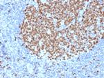 Ki-67 Antibody in Immunohistochemistry (Paraffin) (IHC (P))