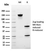 Ki-67 Antibody in SDS-PAGE (SDS-PAGE)