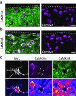 CaMKII alpha Antibody in Immunohistochemistry (IHC)