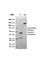 Myeloperoxidase/MPO Antibody in SDS-PAGE (SDS-PAGE)