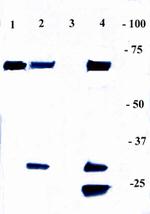 NFkB p65 Antibody in Immunoprecipitation (IP)