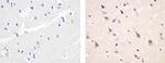 Phospho-PDGFRA (Tyr754) Antibody in Immunohistochemistry (Paraffin) (IHC (P))