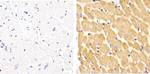 Phospho-Vinculin (Tyr822) Antibody in Immunohistochemistry (Paraffin) (IHC (P))