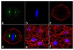 Phospho-Aurora A (Thr288) Antibody in Immunocytochemistry (ICC/IF)