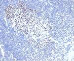 MSH2 Antibody in Immunohistochemistry (Paraffin) (IHC (P))