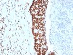 MSH2 (DNA Mismatch Repair Marker) Antibody in Immunohistochemistry (Paraffin) (IHC (P))