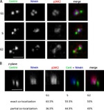 Phospho-JAK2 (Tyr1007, Tyr1008) Antibody in Immunocytochemistry (ICC/IF)