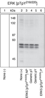 Phospho-ERK5 (Thr218, Tyr220) Antibody in Western Blot (WB)