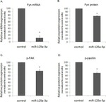 Phospho-FAK (Tyr397) Antibody in Western Blot (WB)