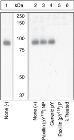 Phospho-Paxillin (Tyr118) Antibody in Western Blot (WB)