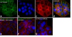 Phospho-EGFR (Tyr845) Antibody