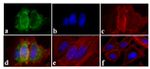 Phospho-EGFR (Tyr845) Antibody in Immunocytochemistry (ICC/IF)