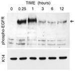 Phospho-EGFR (Tyr1068) Antibody in Western Blot (WB)