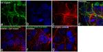 Phospho-EGFR (Tyr1068) Antibody in Immunocytochemistry (ICC/IF)