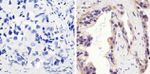 Phospho-EGFR (Tyr1173) Antibody in Immunohistochemistry (Paraffin) (IHC (P))