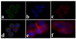 Phospho-IR/IGF1R (Tyr1158) Antibody