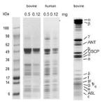 ATP5A1 Antibody in Immunoprecipitation (IP)