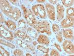 MTAP (Tumor Suppressor Marker) Antibody in Immunohistochemistry (Paraffin) (IHC (P))