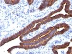 MUC1/CA15-3/EMA/CD227 (Epithelial Marker) Antibody in Immunohistochemistry (Paraffin) (IHC (P))