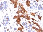 MUC1/CA15-3/EMA/CD227 (Epithelial Marker) Antibody in Immunohistochemistry (Paraffin) (IHC (P))