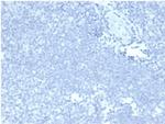 MUC5AC (Mucin 5AC/Gastric Mucin) Antibody in Immunohistochemistry (Paraffin) (IHC (P))