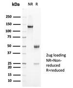 MUC5AC (Mucin 5AC/Gastric Mucin) Antibody in SDS-PAGE (SDS-PAGE)