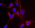 NNT Antibody in Immunocytochemistry (ICC/IF)