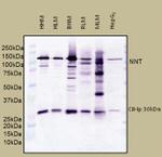 NNT Antibody in Western Blot (WB)