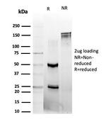L-Myc/MYCL1 (Transcription Factor) Antibody in SDS-PAGE (SDS-PAGE)